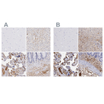 FIBB Antibody in Immunohistochemistry (Paraffin) (IHC (P))