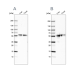 FIBB Antibody in Western Blot (WB)