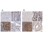 TRF2 Antibody in Immunohistochemistry (Paraffin) (IHC (P))