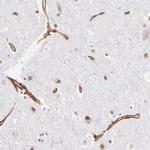 Laminin gamma-1 Antibody in Immunohistochemistry (Paraffin) (IHC (P))