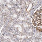 Laminin gamma-1 Antibody in Immunohistochemistry (Paraffin) (IHC (P))
