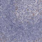 Laminin gamma-1 Antibody in Immunohistochemistry (Paraffin) (IHC (P))