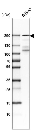 Laminin gamma-1 Antibody in Western Blot (WB)