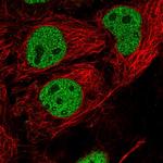 SOX6 Polyclonal Antibody