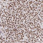 SOX6 Antibody in Immunohistochemistry (Paraffin) (IHC (P))