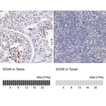SOX6 Antibody in Immunohistochemistry (Paraffin) (IHC (P))