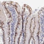 SOX6 Antibody in Immunohistochemistry (Paraffin) (IHC (P))