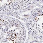 SOX6 Antibody in Immunohistochemistry (Paraffin) (IHC (P))