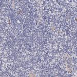 SOX6 Antibody in Immunohistochemistry (Paraffin) (IHC (P))