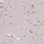 MA2 Antibody in Immunohistochemistry (Paraffin) (IHC (P))