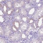 MA2 Antibody in Immunohistochemistry (Paraffin) (IHC (P))