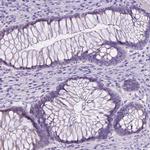 MA2 Antibody in Immunohistochemistry (Paraffin) (IHC (P))