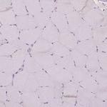 MA2 Polyclonal Antibody