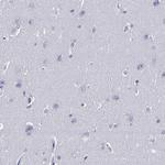 CD36 Antibody in Immunohistochemistry (Paraffin) (IHC (P))