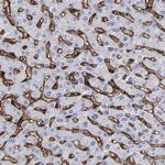 CD36 Antibody in Immunohistochemistry (Paraffin) (IHC (P))