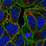 FGR Polyclonal Antibody