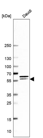 FGR Antibody in Western Blot (WB)