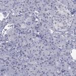 IRF4 Antibody in Immunohistochemistry (Paraffin) (IHC (P))