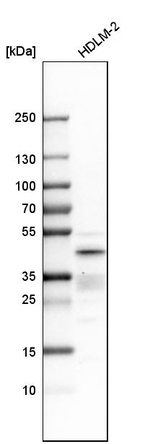 IRF4 Antibody in Western Blot (WB)