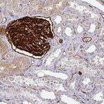 PODXL Antibody in Immunohistochemistry (Paraffin) (IHC (P))