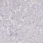 PODXL Antibody in Immunohistochemistry (Paraffin) (IHC (P))