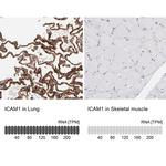 ICAM-1 Antibody