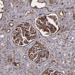 ICAM-1 Antibody in Immunohistochemistry (Paraffin) (IHC (P))