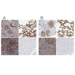 ICAM-1 Polyclonal Antibody