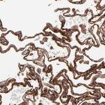 ICAM-1 Antibody in Immunohistochemistry (Paraffin) (IHC (P))