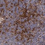 ICAM-1 Antibody in Immunohistochemistry (Paraffin) (IHC (P))