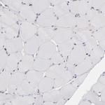 ICAM-1 Antibody in Immunohistochemistry (Paraffin) (IHC (P))