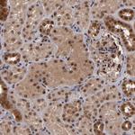 Cullin 5 Antibody in Immunohistochemistry (Paraffin) (IHC (P))
