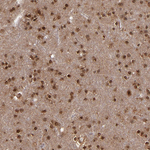 Cullin 5 Antibody in Immunohistochemistry (Paraffin) (IHC (P))