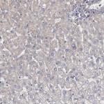CD55 Antibody in Immunohistochemistry (Paraffin) (IHC (P))