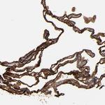 CD55 Antibody in Immunohistochemistry (Paraffin) (IHC (P))