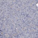 CD55 Antibody in Immunohistochemistry (Paraffin) (IHC (P))