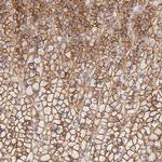 P-Glycoprotein Antibody in Immunohistochemistry (Paraffin) (IHC (P))