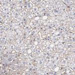 P-Glycoprotein Antibody in Immunohistochemistry (Paraffin) (IHC (P))