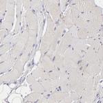 P-Glycoprotein Antibody in Immunohistochemistry (Paraffin) (IHC (P))