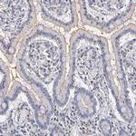 P-Glycoprotein Antibody in Immunohistochemistry (Paraffin) (IHC (P))