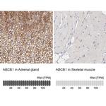 P-Glycoprotein Antibody