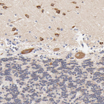 HS3ST1 Antibody in Immunohistochemistry (Paraffin) (IHC (P))