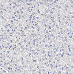 HS3ST1 Antibody in Immunohistochemistry (Paraffin) (IHC (P))