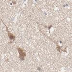 TCP-1 epsilon Antibody in Immunohistochemistry (Paraffin) (IHC (P))