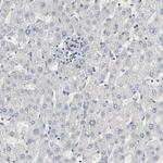 TCP-1 epsilon Antibody in Immunohistochemistry (Paraffin) (IHC (P))