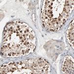 TCP-1 epsilon Antibody in Immunohistochemistry (Paraffin) (IHC (P))