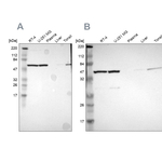 TCP-1 epsilon Antibody in Western Blot (WB)