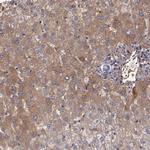 A2M Polyclonal Antibody