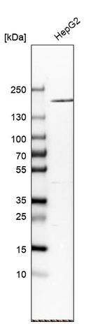 A2M Antibody in Western Blot (WB)