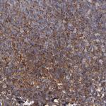 MVP Antibody in Immunohistochemistry (Paraffin) (IHC (P))